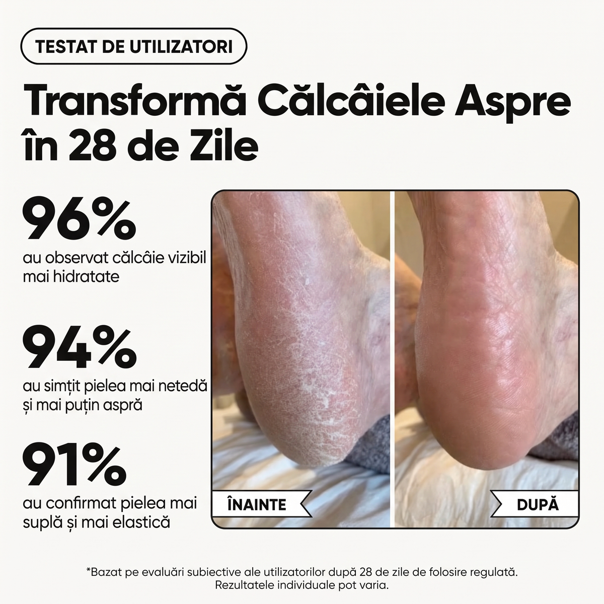 Cremă Naturală de Picioare & Călcâie