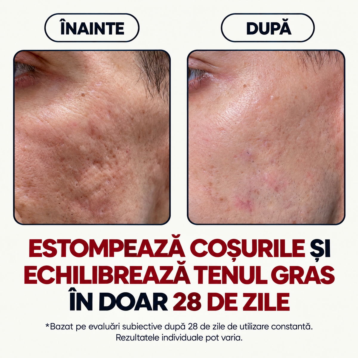 Cremă Naturală Ten Gras & Acneic